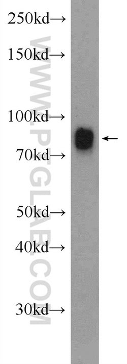 IFFO1 Rabbit anti-Human, Mouse, Rat, Polyclonal, Proteintech:Antibodies:Primary