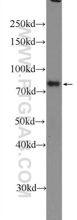 IFFO1 Rabbit anti-Human, Mouse, Rat, Polyclonal, Proteintech:Antibodies:Primary