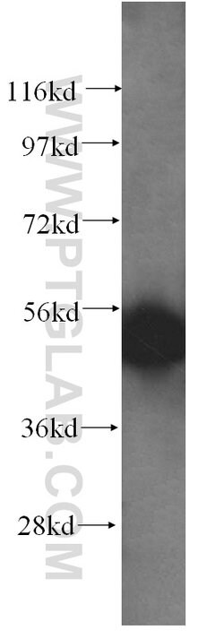 SNX15 Rabbit anti-Human, Mouse, Rat, Polyclonal, Proteintech 150 &mu;L | Buy Online | Proteintech Group Inc | Fisher Scientific