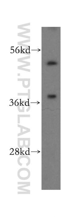 SNX15 Rabbit anti-Human, Mouse, Rat, Polyclonal, Proteintech 150 &mu;L | Buy Online | Proteintech Group Inc | Fisher Scientific