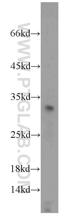 TSPAN1 Rabbit anti-Human, Mouse, Rat, Polyclonal, Proteintech 20 &mu;L;