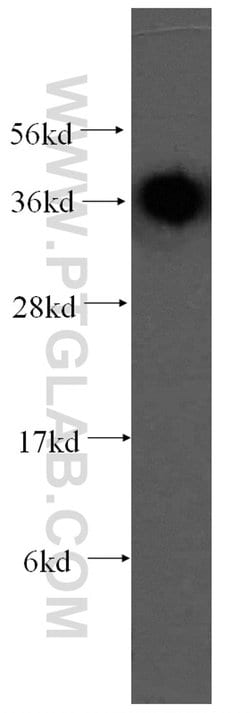 RDH13 Rabbit anti-Human, Mouse, Rat, Polyclonal, Proteintech:Antibodies:Primary