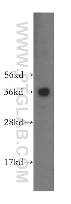 RDH13 Rabbit anti-Human, Mouse, Rat, Polyclonal, Proteintech:Antibodies:Primary