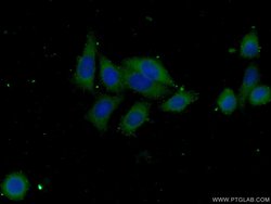 SEC24C Rabbit anti-Human, Mouse, Rat, Polyclonal, Proteintech 150 &mu;L;