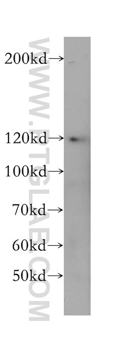 SEC24C Rabbit anti-Human, Mouse, Rat, Polyclonal, Proteintech:  