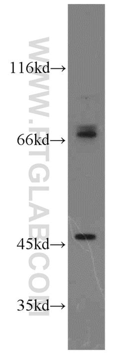 PIAS2 Rabbit anti-Human, Mouse, Rat, Polyclonal, Proteintech:Antibodies:Primary