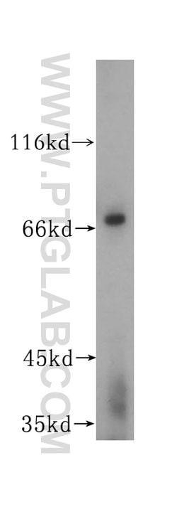 PIAS2 Rabbit anti-Human, Mouse, Rat, Polyclonal, Proteintech:Antibodies:Primary