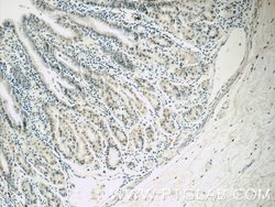 PCIF1 Rabbit anti-Human, Mouse, Polyclonal, Proteintech 150 &mu;L; Unconjugated:Antibodies,