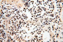 PCIF1 Rabbit anti-Human, Mouse, Polyclonal, Proteintech 150 &mu;L; Unconjugated:Antibodies,