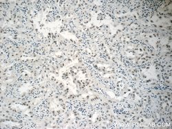 PCIF1 Rabbit anti-Human, Mouse, Polyclonal, Proteintech 150 &mu;L; Unconjugated:Antibodies,