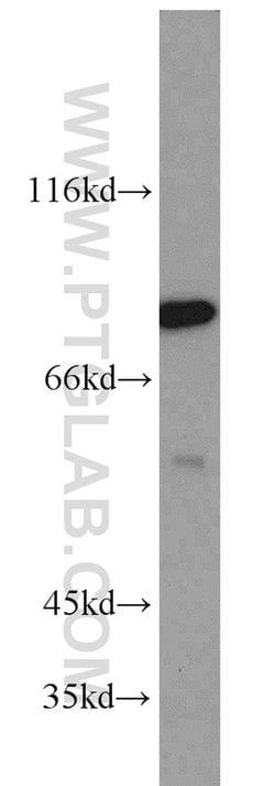 PCIF1 Rabbit anti-Human, Mouse, Polyclonal, Proteintech 150 &mu;L; Unconjugated:Antibodies,