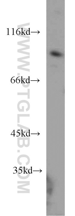 NOL9 Rabbit anti-Human, Polyclonal, Proteintech:Antibodies:Primary Antibodies