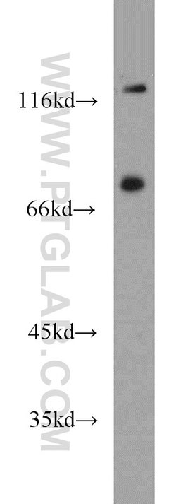 NOL9 Rabbit anti-Human, Polyclonal, Proteintech:Antibodies:Primary Antibodies