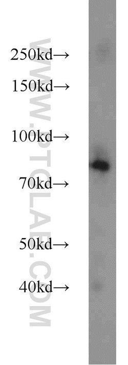 NOL9 Rabbit anti-Human, Polyclonal, Proteintech:Antibodies:Primary Antibodies