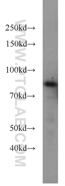 NOL9 Rabbit anti-Human, Polyclonal, Proteintech:Antibodies:Primary Antibodies