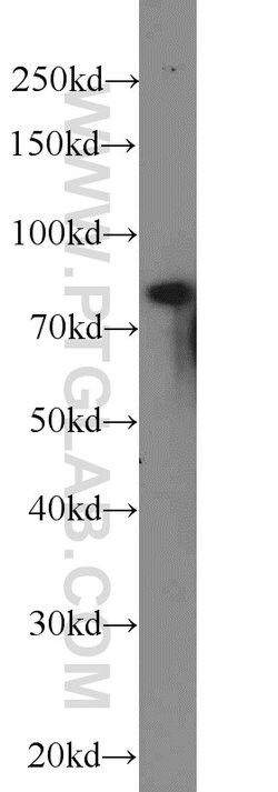 NOL9 Rabbit anti-Human, Polyclonal, Proteintech:Antibodies:Primary Antibodies