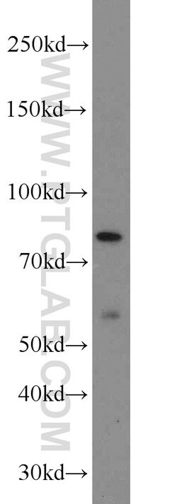 NOL9 Rabbit anti-Human, Polyclonal, Proteintech:Antibodies:Primary Antibodies