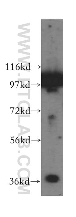 GNB2 Rabbit anti-Human, Mouse, Rat, Polyclonal, Proteintech 20 &mu;L; Unconjugated:Antibodies,