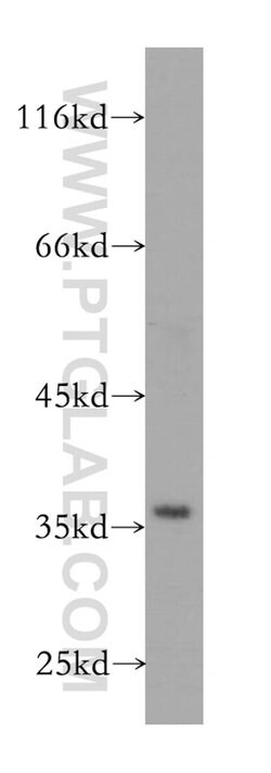 GNB2 Rabbit anti-Human, Mouse, Rat, Polyclonal, Proteintech 20 &mu;L; Unconjugated:Antibodies,