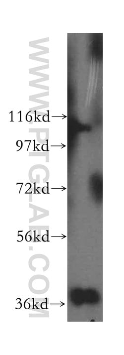 GNB2 Rabbit anti-Human, Mouse, Rat, Polyclonal, Proteintech 20 &mu;L; Unconjugated:Antibodies,