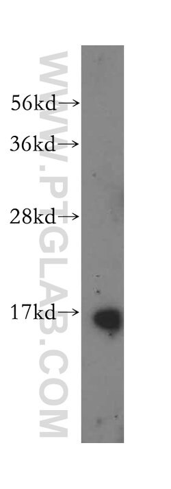 POLR2D Rabbit anti-Human, Mouse, Rat, Polyclonal, Proteintech 150 &mu;L;