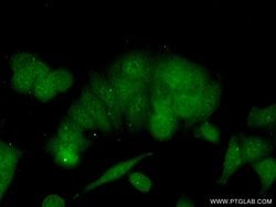 BRMS1 Rabbit anti-Human, Polyclonal, Proteintech:Antibodies:Primary Antibodies