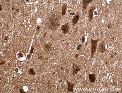 BRMS1 Rabbit anti-Human, Polyclonal, Proteintech:Antibodies:Primary Antibodies