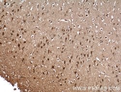 BRMS1 Rabbit anti-Human, Polyclonal, Proteintech:Antibodies:Primary Antibodies