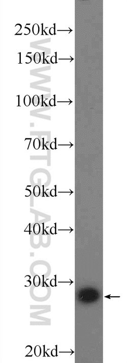 BRMS1 Rabbit anti-Human, Polyclonal, Proteintech:Antibodies:Primary Antibodies