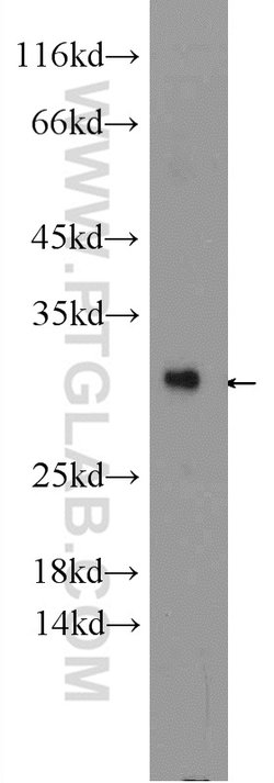 BRMS1 Rabbit anti-Human, Polyclonal, Proteintech:Antibodies:Primary Antibodies