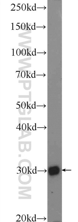 BRMS1 Rabbit anti-Human, Polyclonal, Proteintech:Antibodies:Primary Antibodies