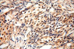 NUDT8 Rabbit anti-Human, Mouse, Rat, Polyclonal, Proteintech 150 &mu;L;