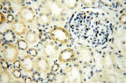 NUDT8 Rabbit anti-Human, Mouse, Rat, Polyclonal, Proteintech 150 &mu;L;