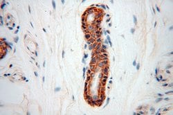 NUDT8 Rabbit anti-Human, Mouse, Rat, Polyclonal, Proteintech 150 &mu;L;