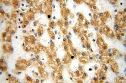 NUDT8 Rabbit anti-Human, Mouse, Rat, Polyclonal, Proteintech 150 &mu;L;