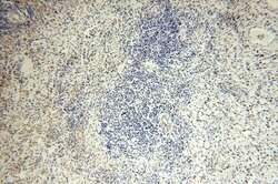 NUDT8 Rabbit anti-Human, Mouse, Rat, Polyclonal, Proteintech 150 &mu;L;