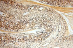 NUDT8 Rabbit anti-Human, Mouse, Rat, Polyclonal, Proteintech 150 &mu;L;