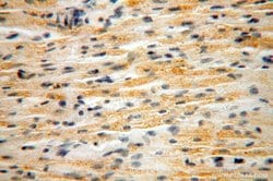 NUDT8 Rabbit anti-Human, Mouse, Rat, Polyclonal, Proteintech 150 &mu;L;