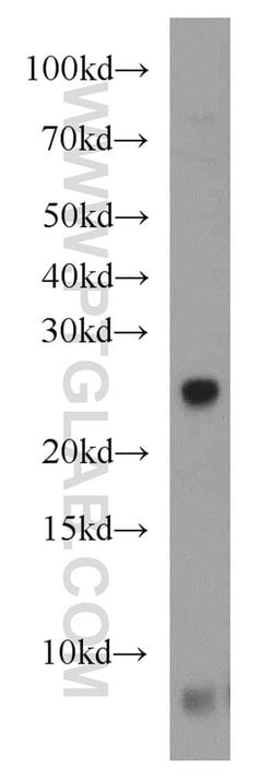 NUDT8 Rabbit anti-Human, Mouse, Rat, Polyclonal, Proteintech 150 &mu;L;