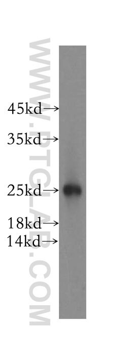 NUDT8 Rabbit anti-Human, Mouse, Rat, Polyclonal, Proteintech 150 &mu;L;