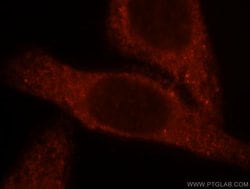 BBOX1 Rabbit anti-Human, Mouse, Rat, Polyclonal, Proteintech:Antibodies:Primary