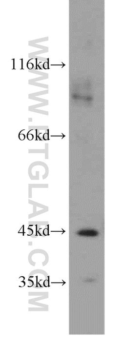BBOX1 Rabbit anti-Human, Mouse, Rat, Polyclonal, Proteintech:Antibodies:Primary