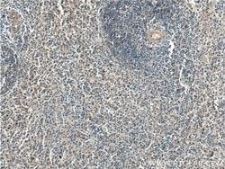 BAMBI Rabbit anti-Human, Mouse, Rat, Polyclonal, Proteintech 20 &mu;L;