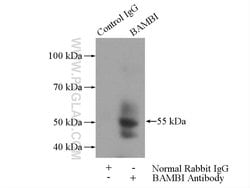 BAMBI Rabbit anti-Human, Mouse, Rat, Polyclonal, Proteintech 20 &mu;L;