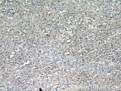 HSF1 Rabbit anti-Human, Mouse, Rat, Polyclonal, Proteintech:Antibodies:Primary