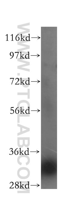 ERGIC1 Rabbit anti-Human, Mouse, Rat, Polyclonal, Proteintech:Antibodies:Primary