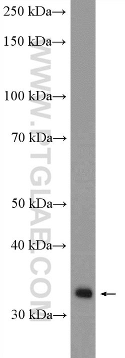 ERGIC1 Rabbit anti-Human, Mouse, Rat, Polyclonal, Proteintech:Antibodies:Primary