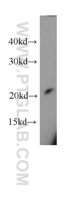 RAC1/2/3 Rabbit anti-Human, Mouse, Rat, Polyclonal, Proteintech:Antibodies:Primary