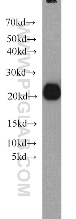RAC1/2/3 Rabbit anti-Human, Mouse, Rat, Polyclonal, Proteintech:Antibodies:Primary