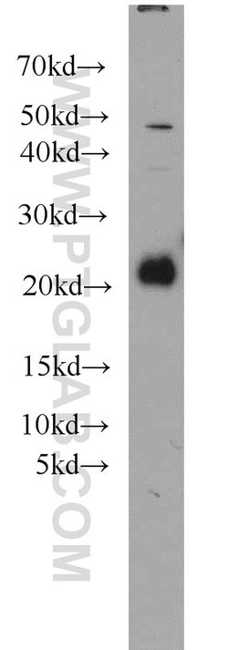 RAC1/2/3 Rabbit anti-Human, Mouse, Rat, Polyclonal, Proteintech:Antibodies:Primary